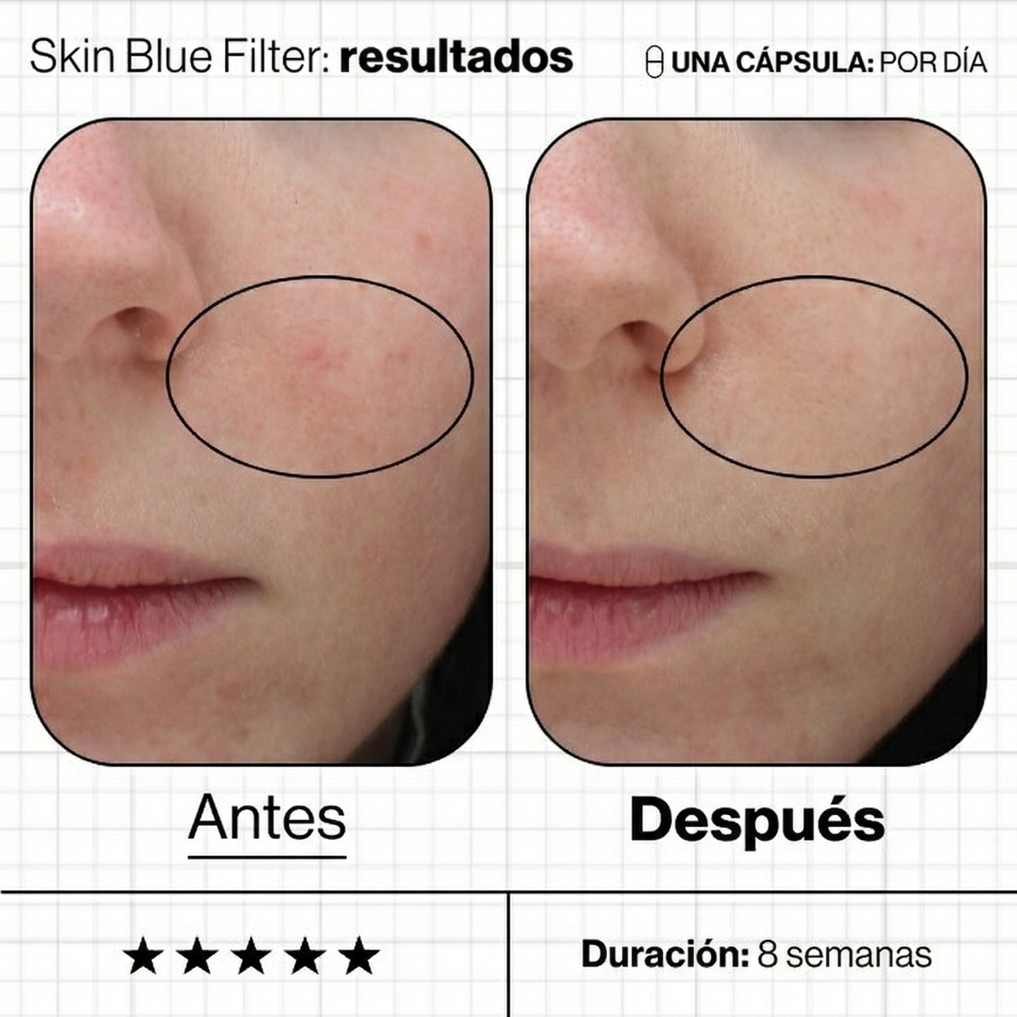 Advanced_Nutrition_Programe_Skin-Blue-Filter-antes-y-despues