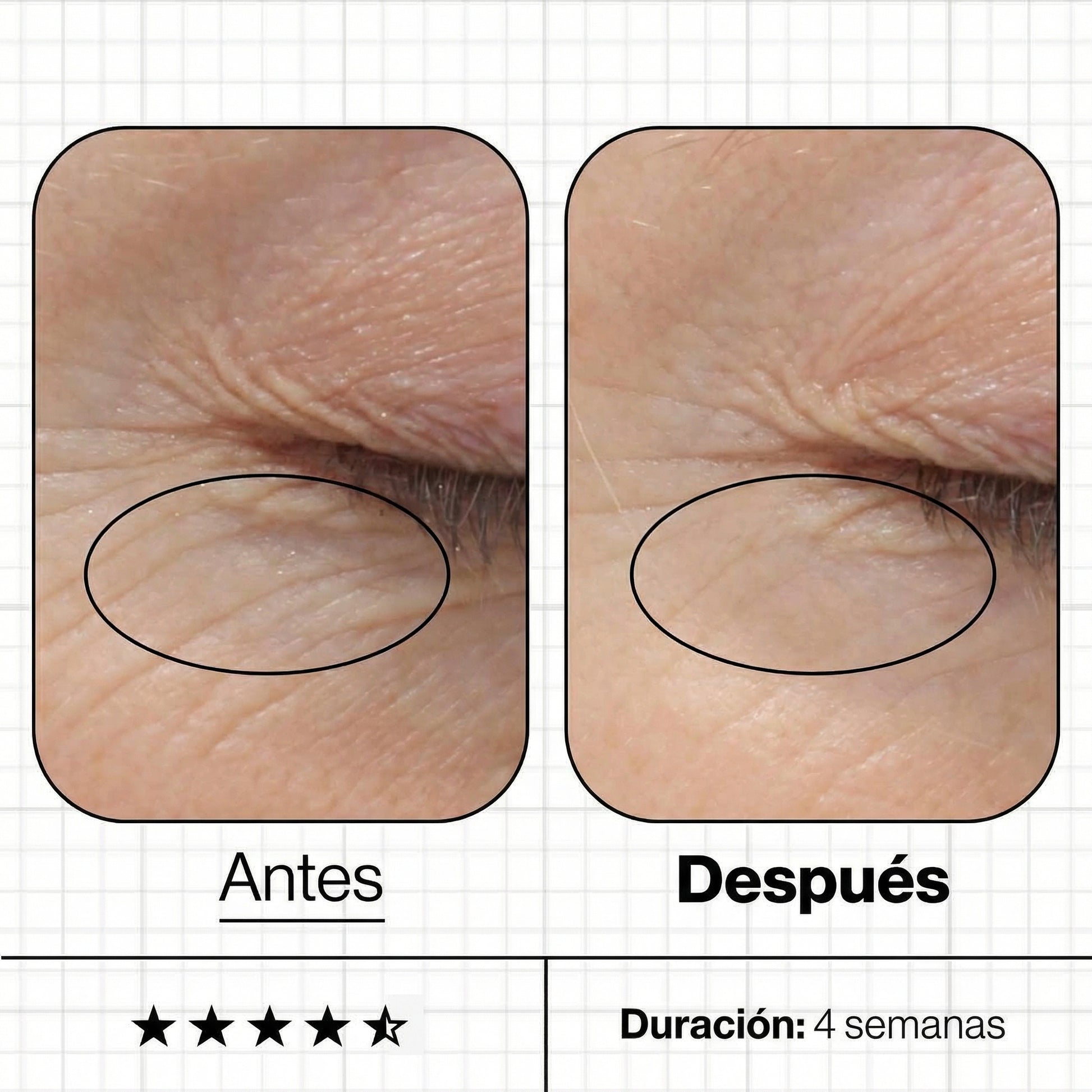Imágenes de "antes y después" tras el uso de Skin Youth Biome, mostrando una mejora visible en la luminosidad de la piel, la reducción de líneas de expresión y un aspecto general más rejuvenecido y saludable.