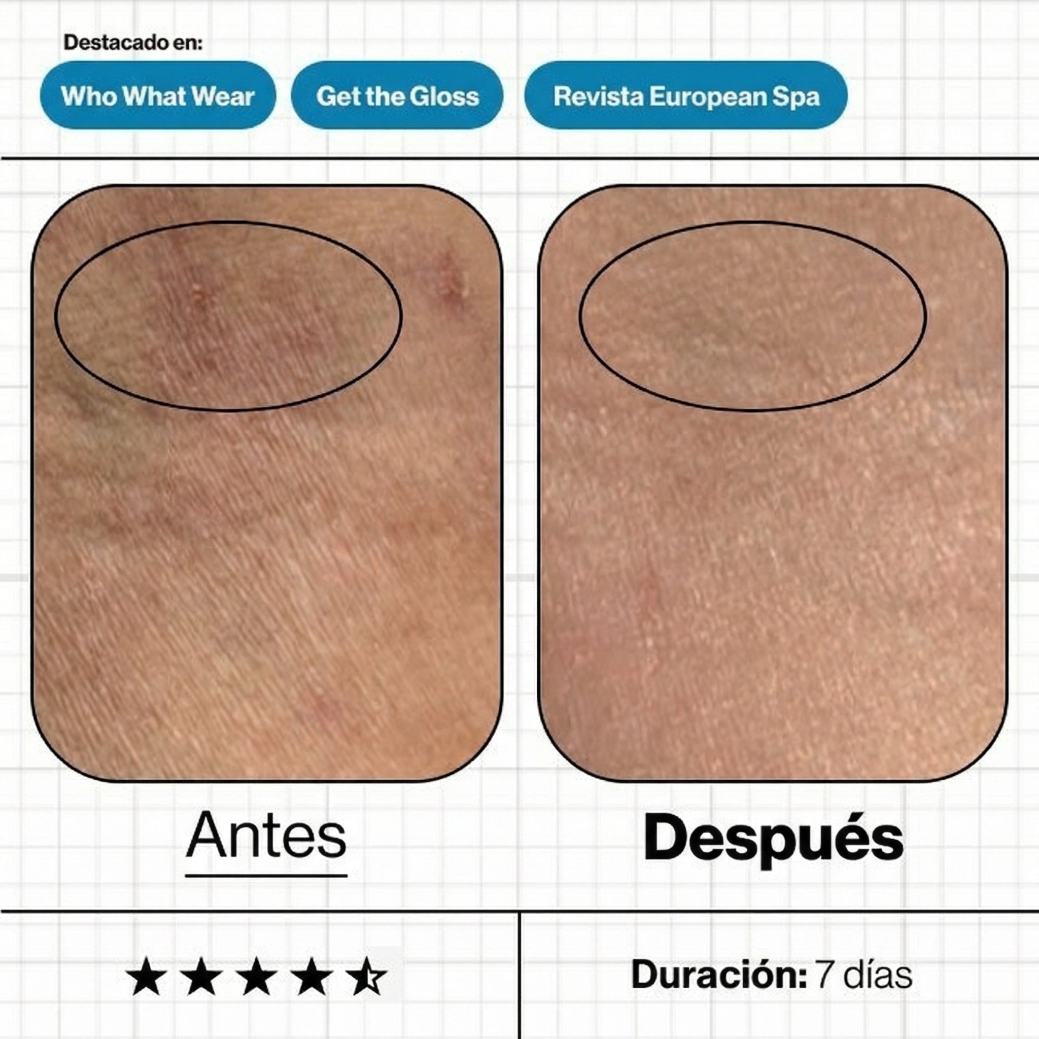 Imágenes de "antes y después" del tratamiento Skin Moisture IQ, mostrando una mejora significativa en los niveles de hidratación, luminosidad y suavidad de la textura cutánea.