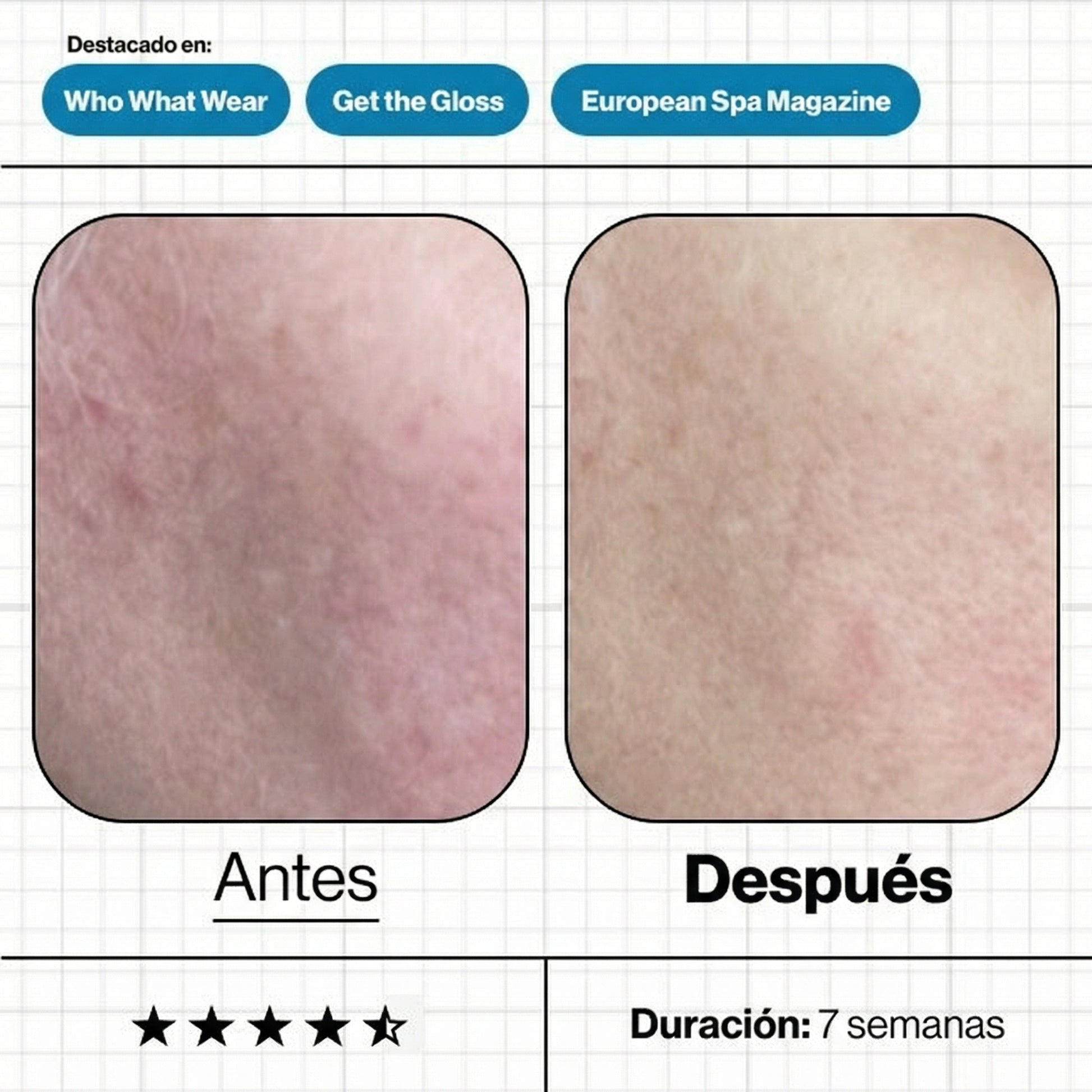 Imágenes de "antes y después" del tratamiento Skin Moisture IQ, mostrando una mejora significativa en los niveles de hidratación, luminosidad y suavidad de la textura cutánea.