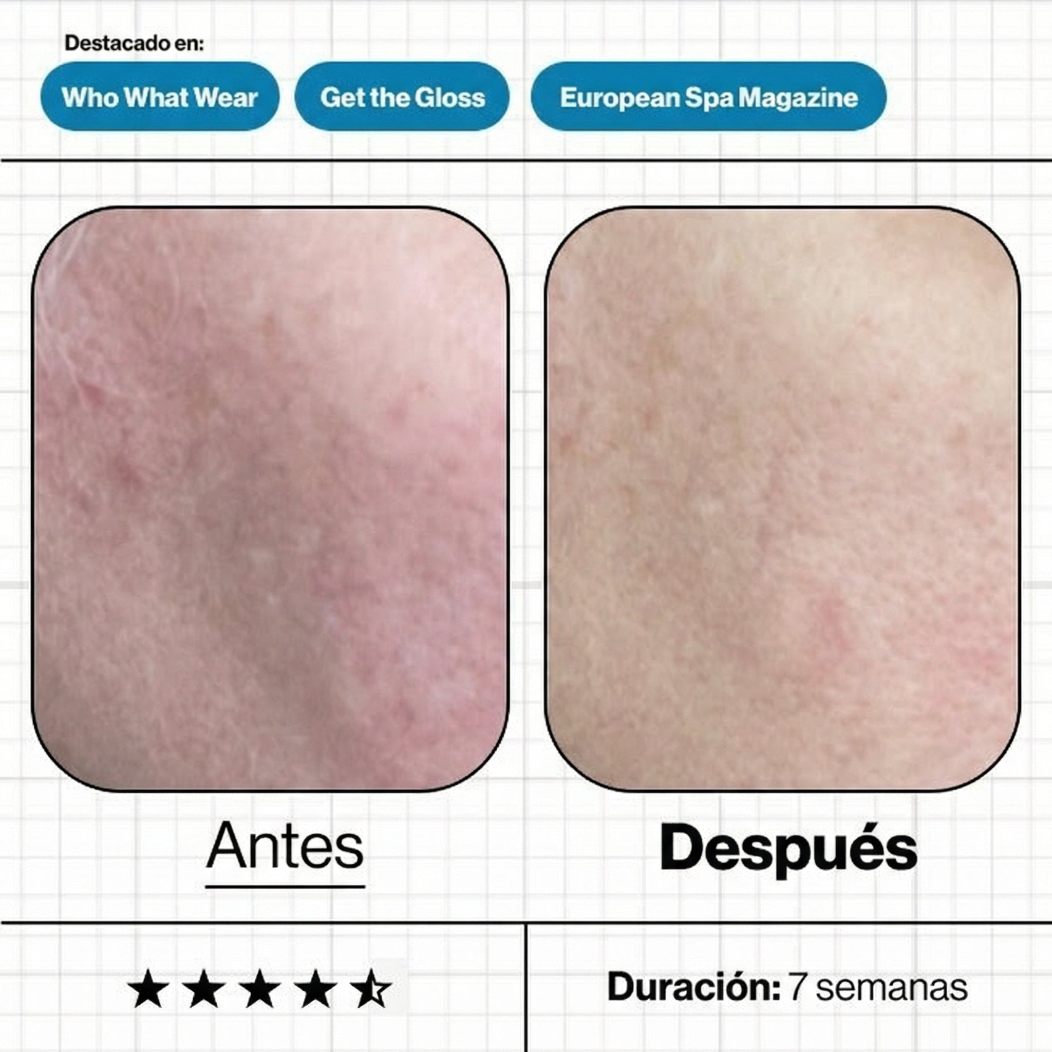 Imágenes de "antes y después" del tratamiento Skin Moisture IQ, mostrando una mejora significativa en los niveles de hidratación, luminosidad y suavidad de la textura cutánea.